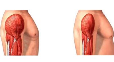 Vieillissement et perte de capacités musculaires